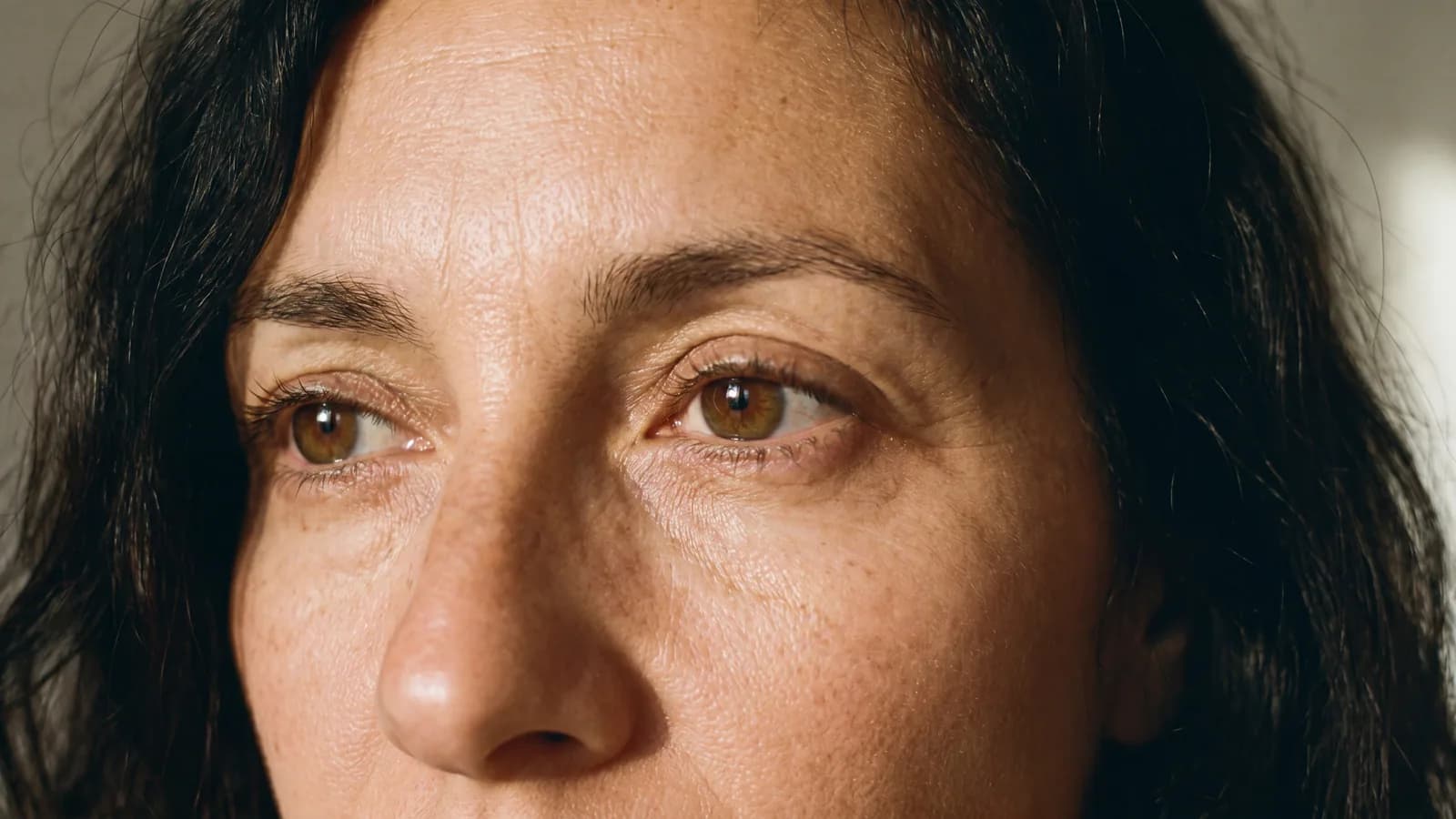 Crow's Feet treatments at Baudelaire Aesthetics, Bath