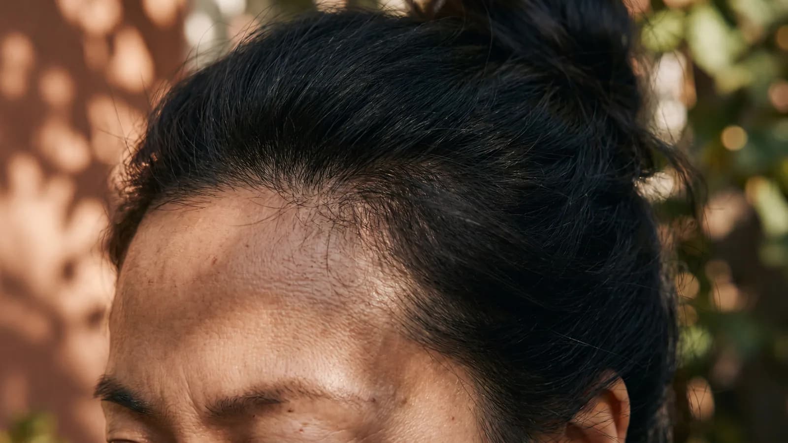 Hair Thinning treatments at Baudelaire Aesthetics, Bath