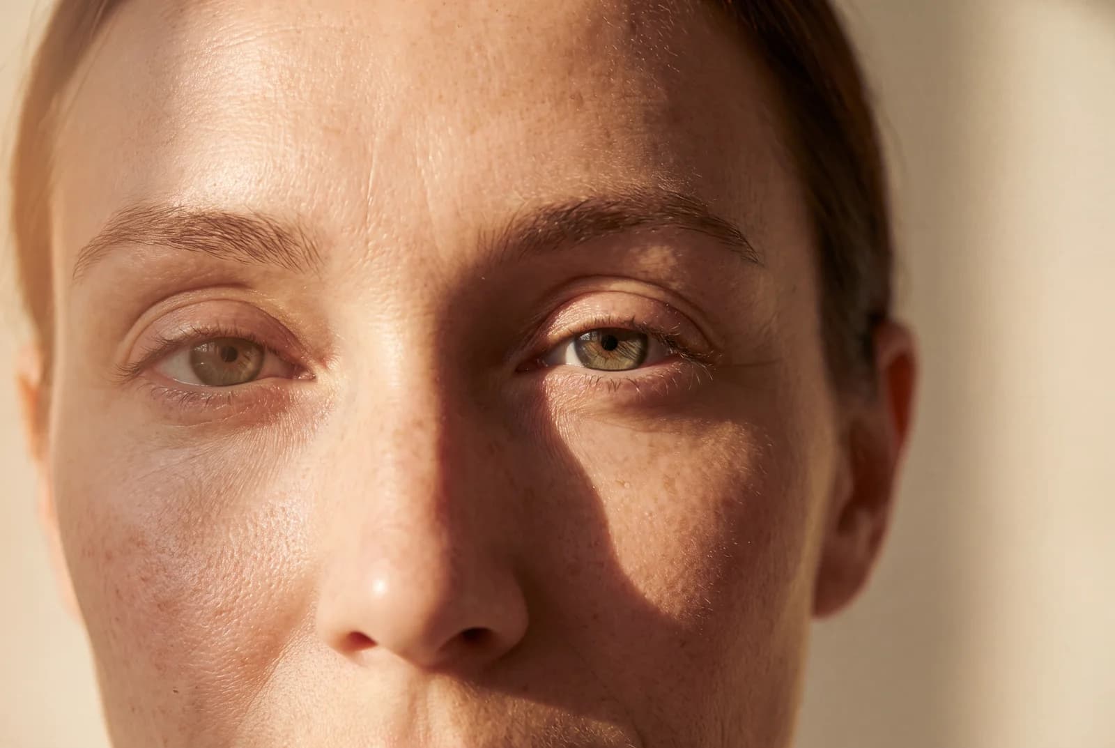 How to Get Rid of Dark Circles Under Your Eyes: Which of the Four Kinds Is Yours