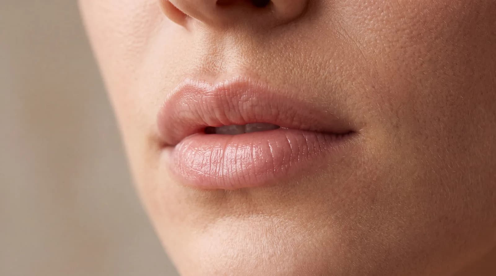 Lip Filler: How It Works, How Long It Lasts, and Keeping It Natural