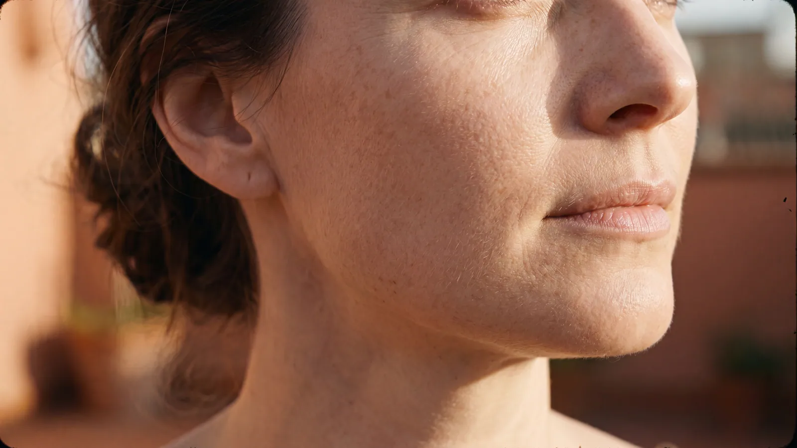 Microneedling, aesthetic treatment at Baudelaire Aesthetics, Bath