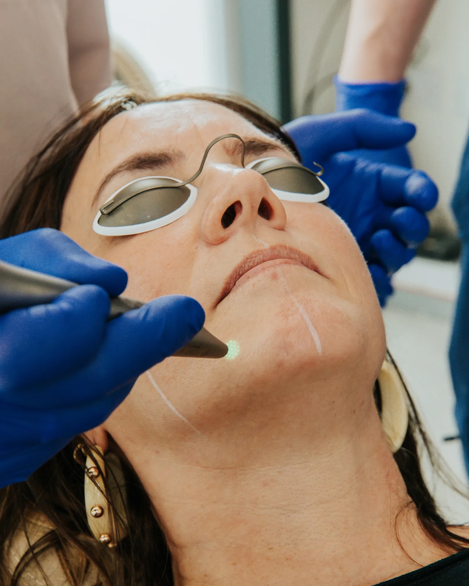 Treatment in progress at the clinic in Bath. The mapped lines guide even coverage across the area being treated, and both patient and operators wear wavelength-specific eye protection throughout.