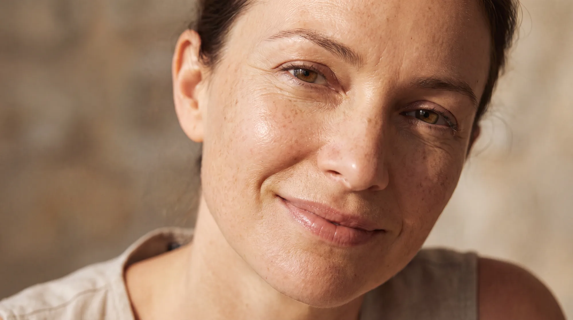 The Vampire Facial: What PRP and Microneedling Actually Do, and Who It Suits